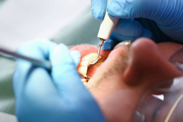 Best Same-Day Emergency Dentist in Clinton, AR