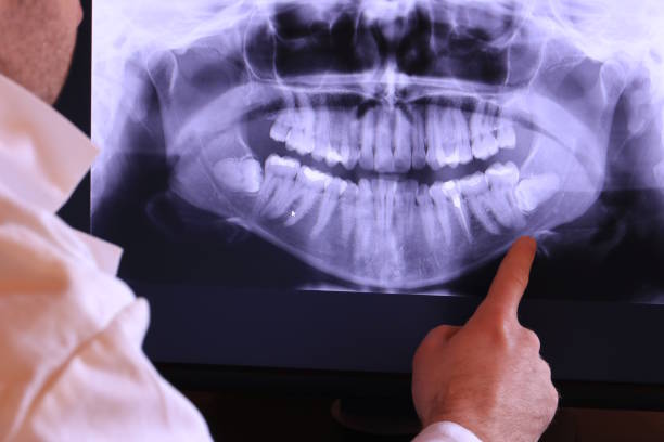 Best Emergency Broken Tooth Repair in Clinton, AR