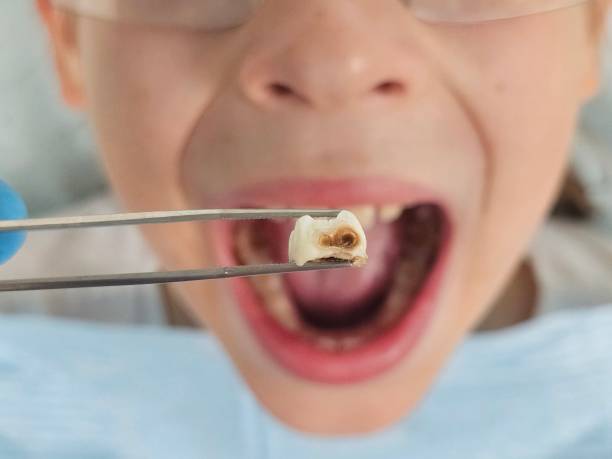 Best Emergency Treatment for Toothache in Clinton, AR